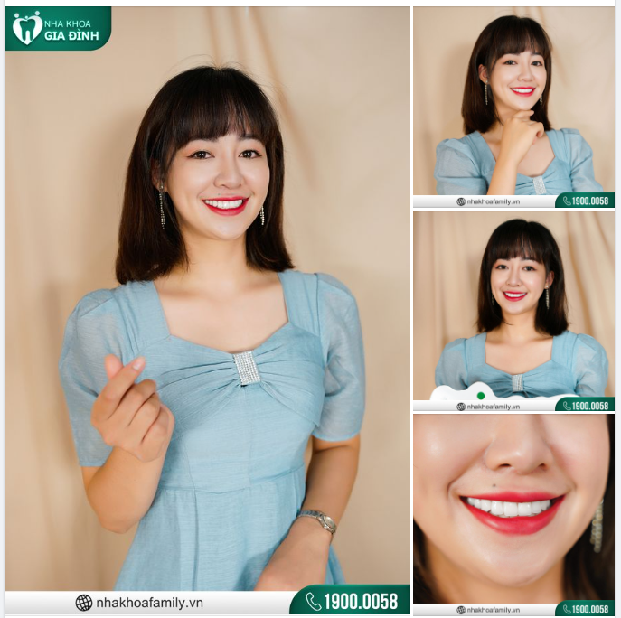MUỐN RĂNG ĐẸP LÀ PHẢI LÀM NGAY!