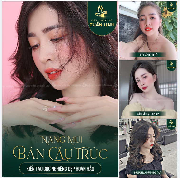 NÂNG MŨI BÁN CẤU TRÚC 24TR999 - KIẾN TẠO GÓC NGHIÊNG ĐẸP HOÀN HẢO!!!