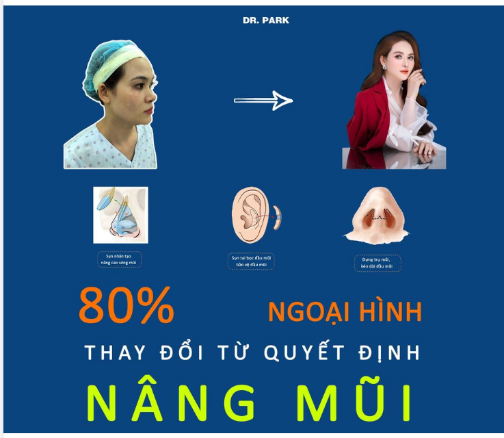 NÂNG MŨI CẤU TRÚC - BƯỚC NGOẶT DẪN TỚI THÀNH CÔNG