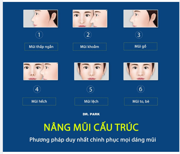 NÂNG MŨI CẤU TRÚC - PHƯƠNG PHÁP DUY NHẤT CHINH PHỤC MỌI DÁNG MŨI