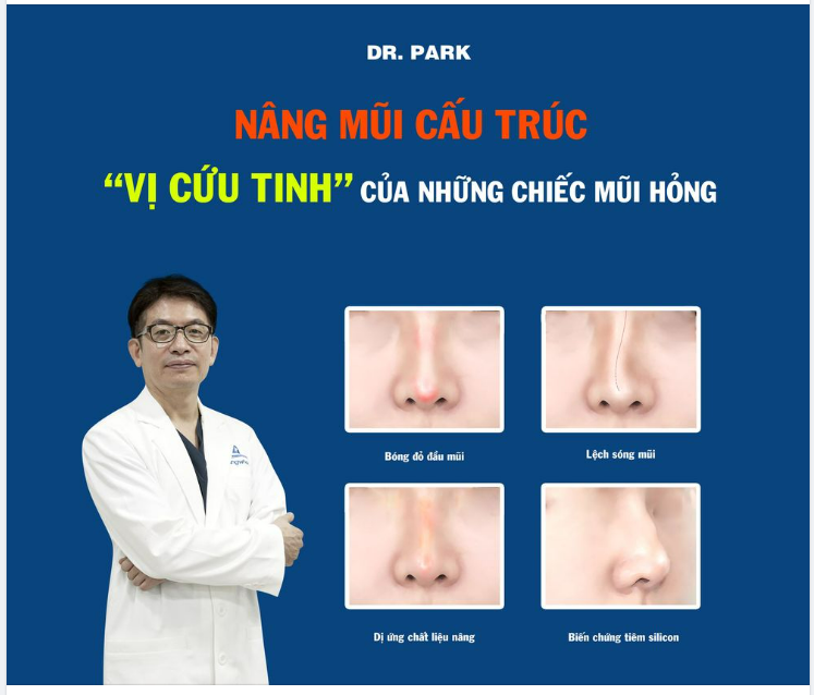 NÂNG MŨI CẤU TRÚC - VỊ CỨU TINH CỦA NHỮNG CHIẾC MŨI HỎNG