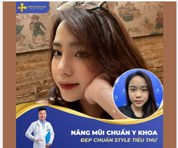 NÂNG MŨI CHUẨN Y KHOA - BÍ QUYẾT CHO GƯƠNG MẶT HOÀN HẢO