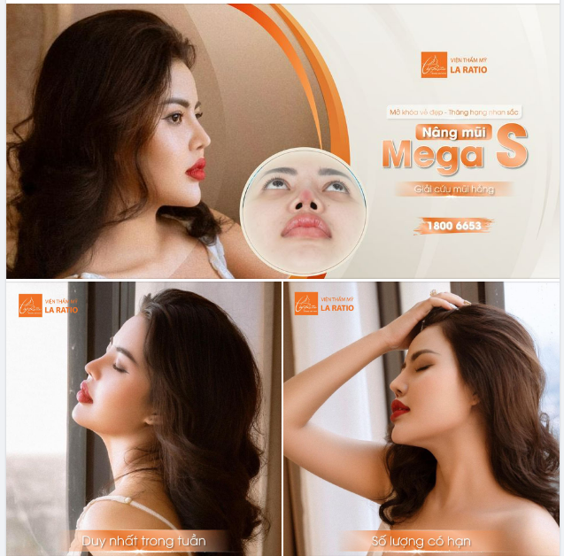 NÂNG MŨI MEGAS - CỨU TINH CỦA NHỮNG CA MŨI HỎNG