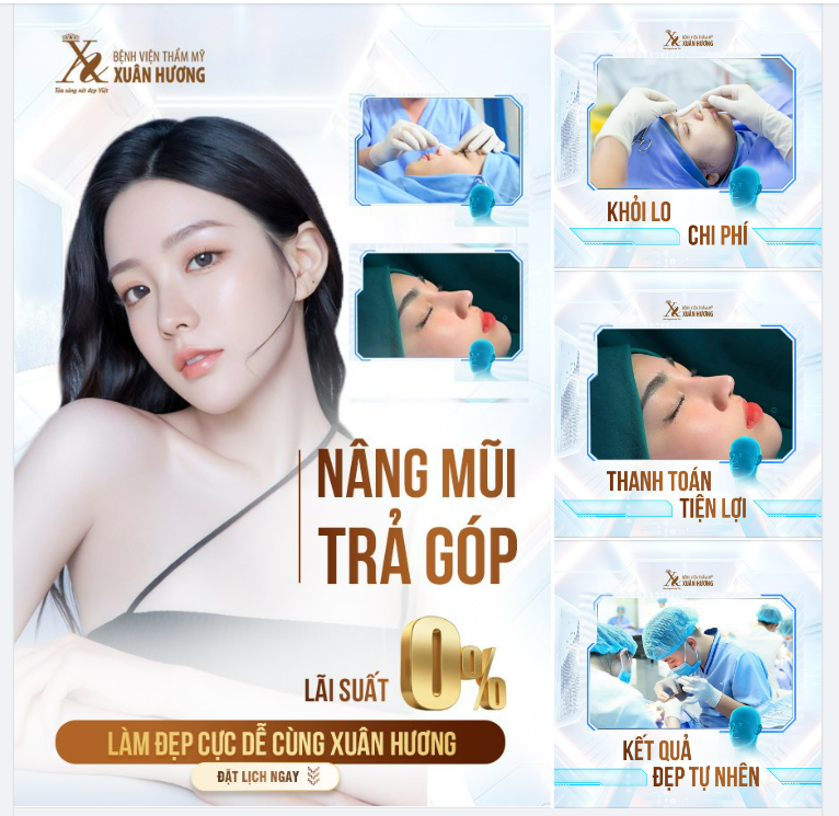 NÂNG MŨI TRẢ GÓP - LÀM ĐẸP CỰC NHANH, THANH TOÁN CỰC DỄ