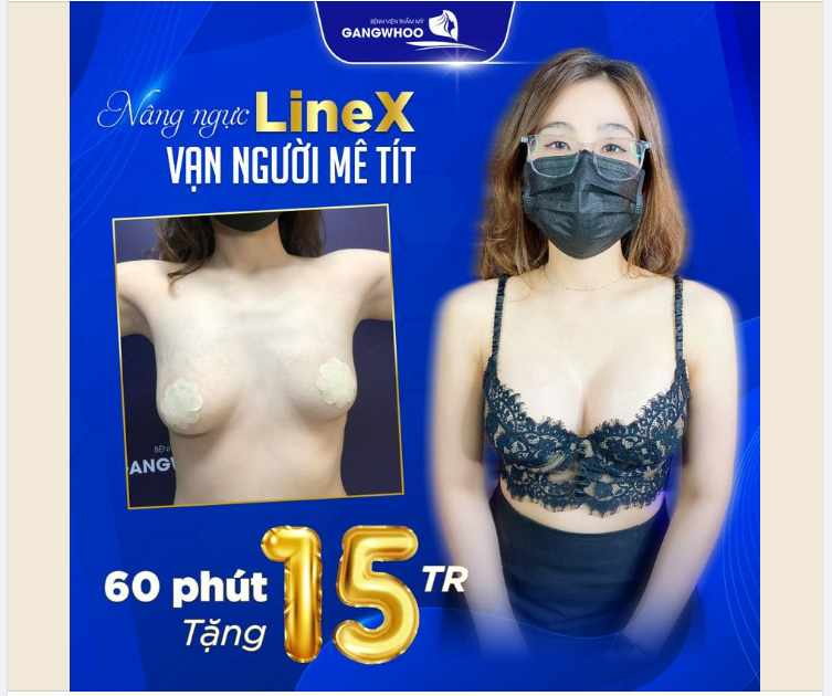 NÂNG NGỰC LINE-X VẠN NGƯỜI MÊ TÍT!