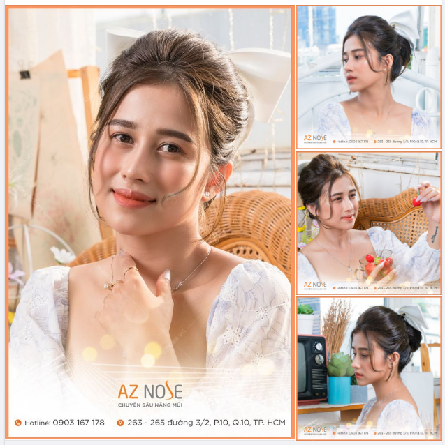 Nàng thơ Trà Vinh xinh ngọt ngào sau 6 tháng nâng mũi