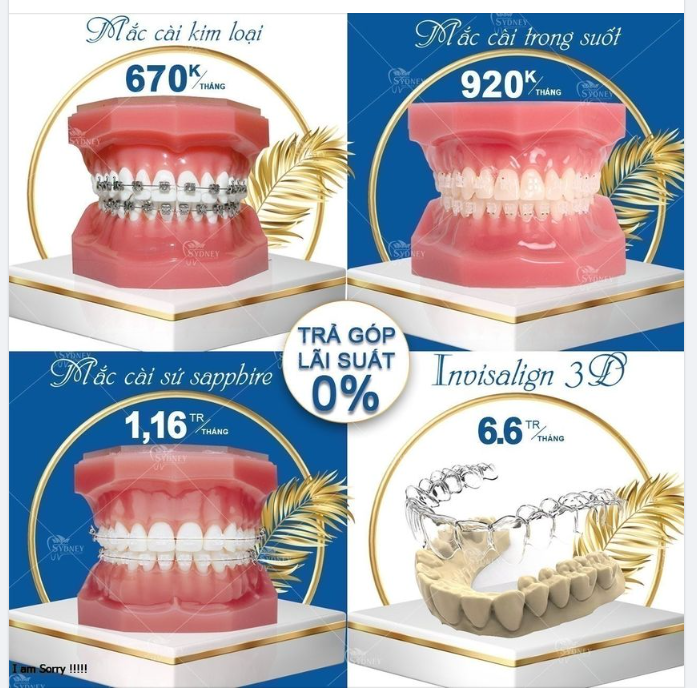 NÊN CHỌN LOẠI NÀO TRƯỚC KHI NIỀNG RĂNG