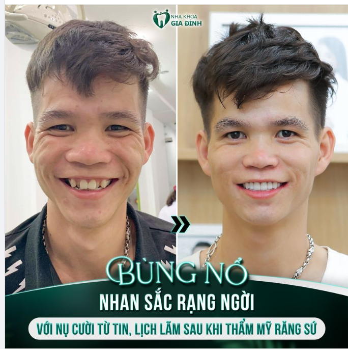 NẾU CÓ THẾ TRẺ ĐẸP HƠN CHỈ SAU 2 NGÀY, TẠI SAO LẠI KHÔNG THỬ?