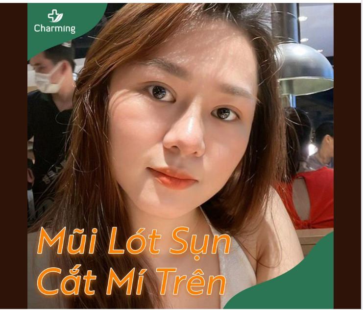 Nếu đã lỡ nâng mũi lót sụn để khuôn mặt thêm đẹp rồi gì tội tình gì chúng ta để nét đẹp bị khuyết bởi đôi mắt chưa rõ đường mí Một lần chơi lớn xem có ai trầm trồ