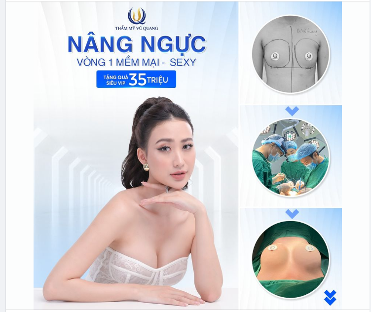 Ng ực đẹp trọn đời - Ưu đãi cực hời