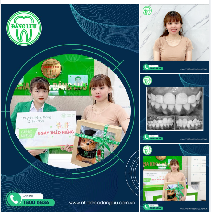 Ngày hôm nay của bạn thế nào?