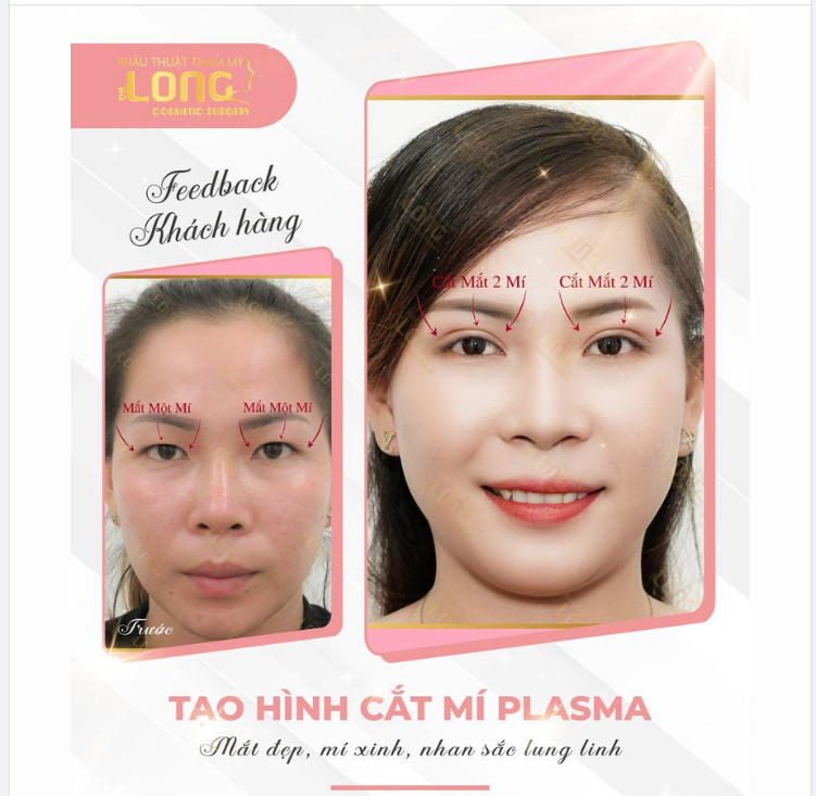 Ngày xưa em xấu bao người chê. Buồn, em chỉ dám chấp nhận rồi lướt qua mọi người. Cố gắng bỏ ngoài tai tất cả, em từng nghĩ chỉ cần mình sống tốt mọi thứ sẽ ổn.