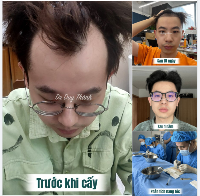 NGHE FEEDBACK KHÁCH CẤY TÓC MÀ SƯỚNG CẢ NGƯỜI