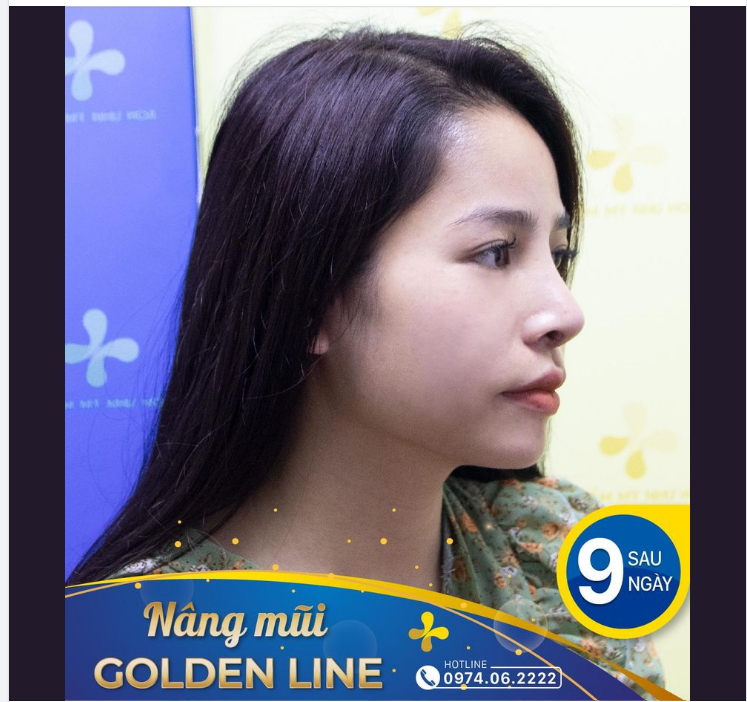 Nghiêng thế này đã đủ để chị em “đổ” chưa nhỉ
