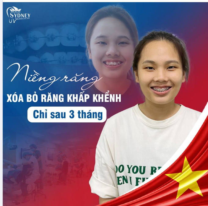 NGỠ NGÀNG SỰ THAY ĐỔI CHỈ SAU 3 THÁNG NIỀNG RĂNG