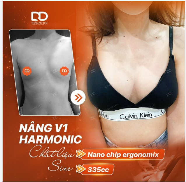 NGỰC TRÒN ĐẦY, KHE SÂU KHÍT SAU NÂNG V1