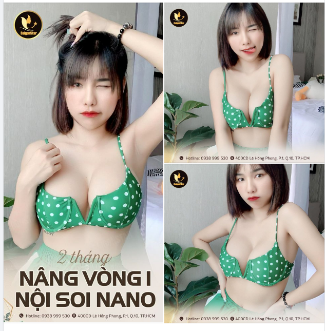 Người thật việc thật Feedback sau 2 tháng nâng ngực của hot girl nhà Dr. Hoạt!