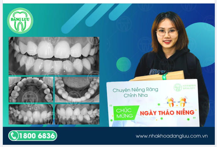 Nha Khoa Đăng Lưu hạnh phúc chào mừng nụ cười rạng rỡ đã niềng răng thành công