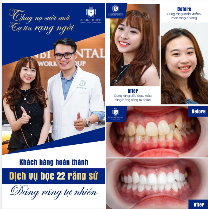 NHAN SẮC THĂNG HẠNG - CƯỜI VẠN NGƯỜI MÊ