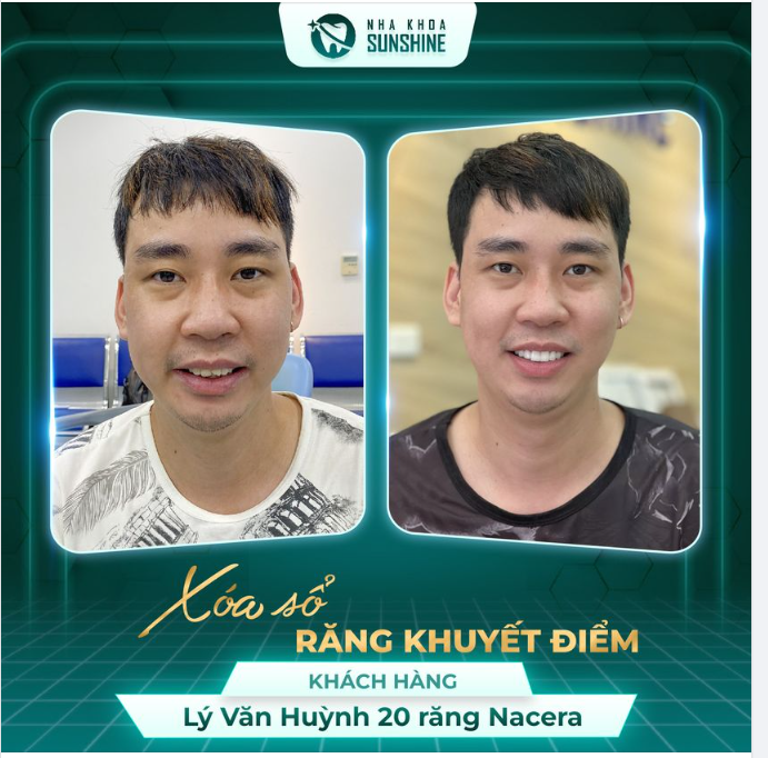 Nhiều người vẫn lầm tưởng rằng, bọc răng sứ chỉ dành cho những người yêu thích cái đẹp, muốn thay đổi nụ cười.