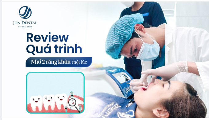 NHỔ 2 RĂNG KHÔN CÙNG 1 LÚC