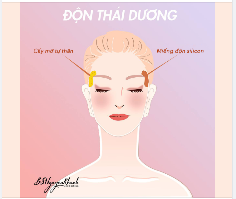 NHỮNG CÂU HỎI GIÚP BẠN LỰA CHỌN CẤY MỠ HAY ĐỘN THÁI DƯƠNG DỄ DÀNG