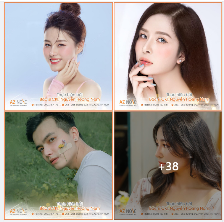 Những dáng mũi “chuẩn không cần chỉnh” được thực hiện bởi Bác sĩ CKI. Nguyễn Hoàng Nam