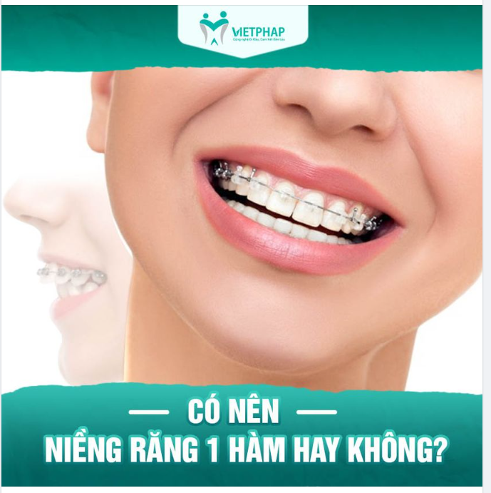NIỀNG RĂNG 1 HÀM HOÀN TOÀN KHẢ THI. TUY NHIÊN…