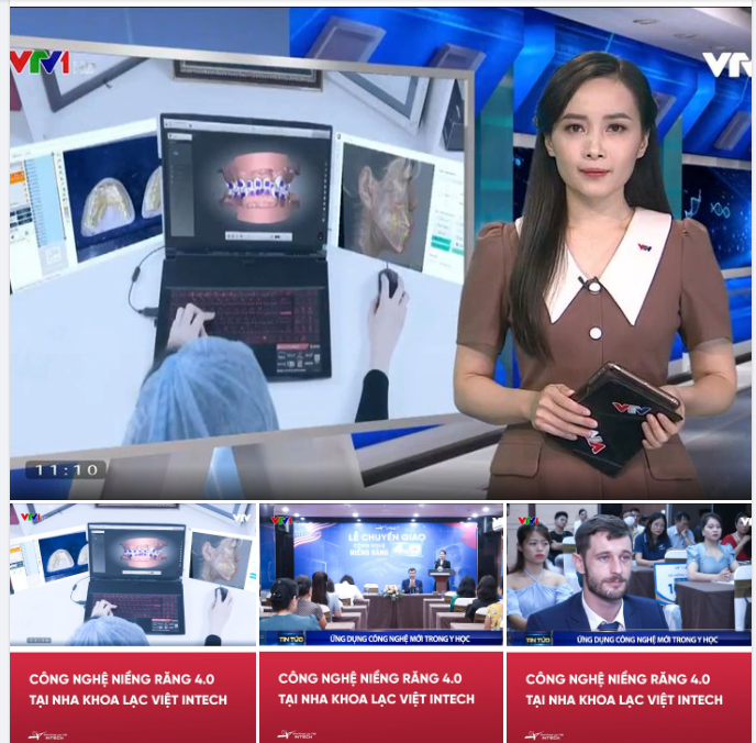 NIỀNG RĂNG CÔNG NGHỆ 4.0 TẠI NHA KHOA LẠC VIỆT INTECH LÊN SÓNG VTV