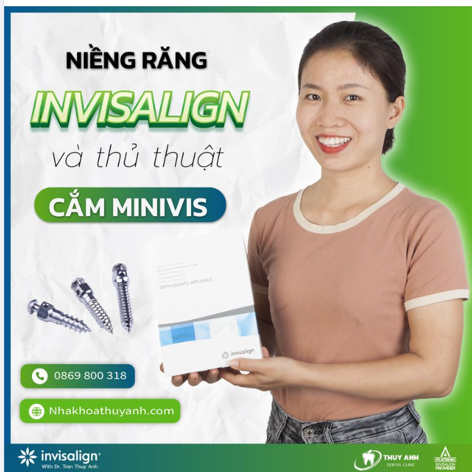 NIỀNG RĂNG INVISALIGN VÀ THỦ THUẬT CẮM MINIVIS