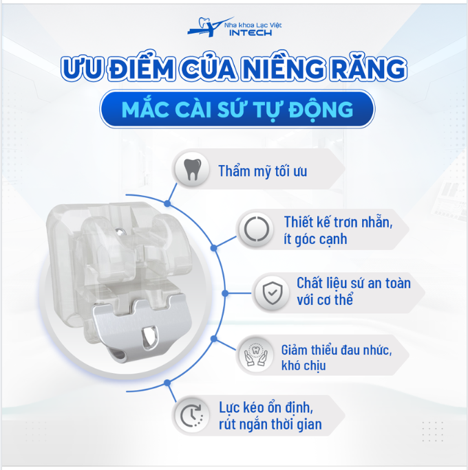 NIỀNG RĂNG MẮC CÀI SỨ TỰ ĐỘNG ĐEM LẠI NHỮNG ƯU ĐIỂM GÌ?