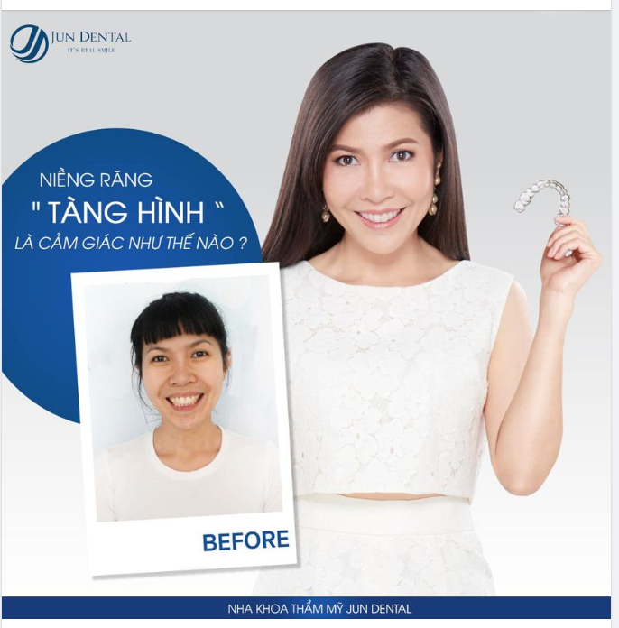 NIỀNG RĂNG "TÀNG HÌNH" LÀ CẢM GIÁC NHƯ THẾ NÀO?