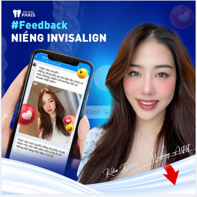 Niềng xong  hết hô - Lãi môi chúm chím