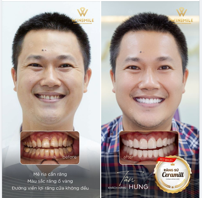 NỤ CƯỜI CẢI VẬN, VIỆC KINH DOANH PHÁT TRIỂN PHI MÃ