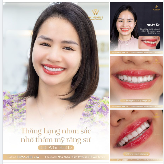 NỤ CƯỜI MANG BẢN SẮC RIÊNG GIÚP THĂNG HẠNG VẺ ĐẸP MỖI NGƯỜI