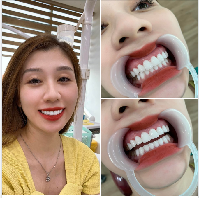 NỤ CƯỜI RẠNG RỠ - MỘT CHUẨN MỰC CỦA CÁI ĐẸP