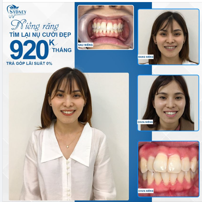 NỤ CƯỜI TƯƠI MỚI - THẦN SẮC RẠNG NGỜI