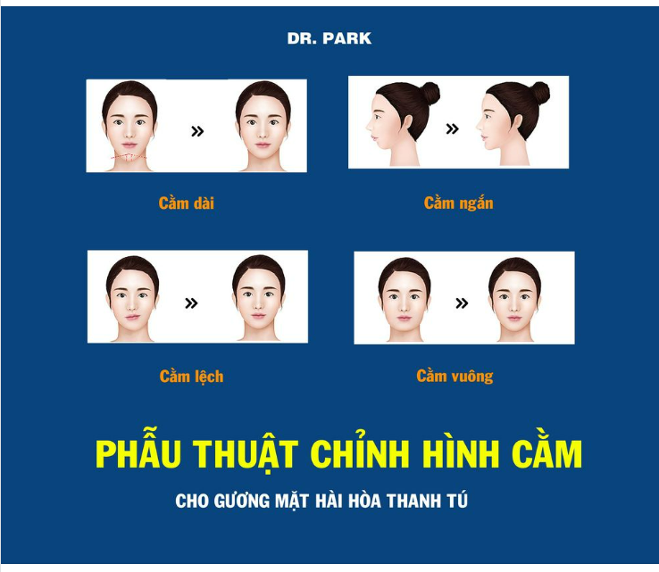 PHẪU THUẬT CHỈNH HÌNH CẰM - CHO GƯƠNG MẶT THANH TÚ