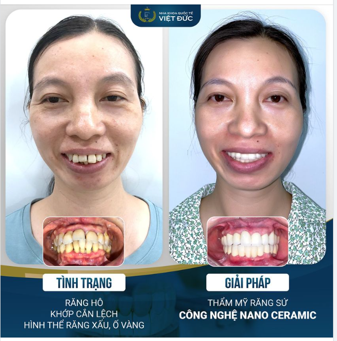PHỤ NỮ LUÔN XỨNG ĐÁNG ĐƯỢC HƯỞNG NHỮNG ĐIỀU TỐT ĐẸP NHẤT