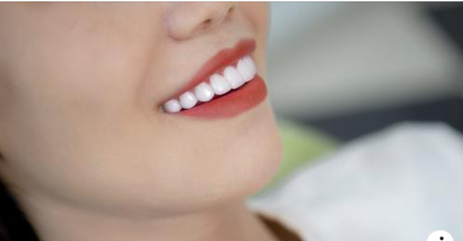 PHỤC HÌNH CHO CA RĂNG KHẤP KHỂNH, NHIỄM MÀU. FORM RĂNG THÔ