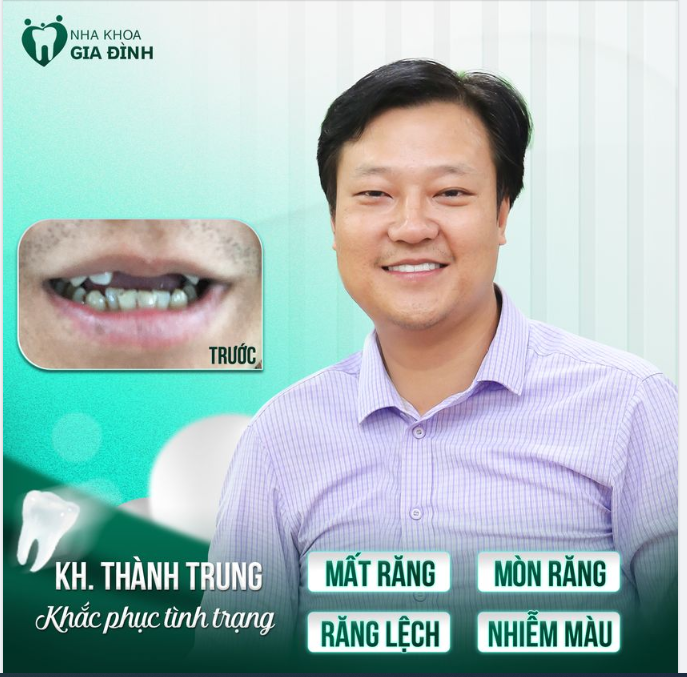 PHỤC HÌNH RĂNG BỊ MẤT LẤY LẠI SỨC KHỎE ĂN NHAI VÀ CẢI THIỆN THẨM MỸ