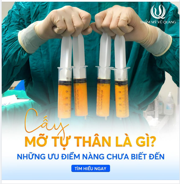 Phương pháp cấy mỡ tự thân là gì