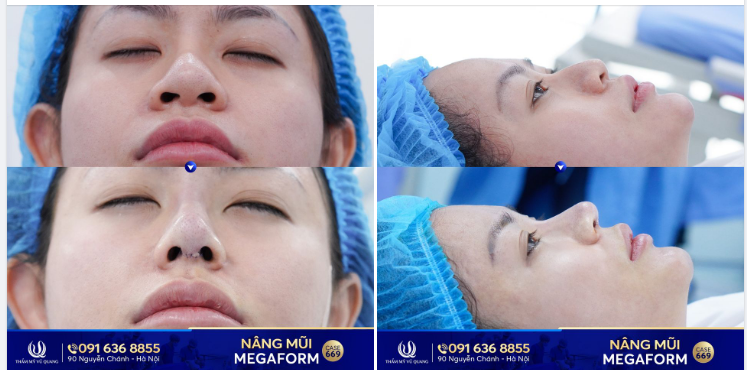 Quyết định bay hơn 800Km để gặp bác sĩ, kết quả thì quá ưng luôn!