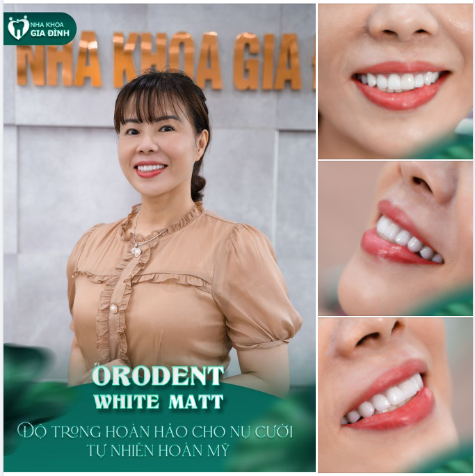 RĂNG ĐẸP - CƯỜI SANG, TĂNG THẦN THÁI