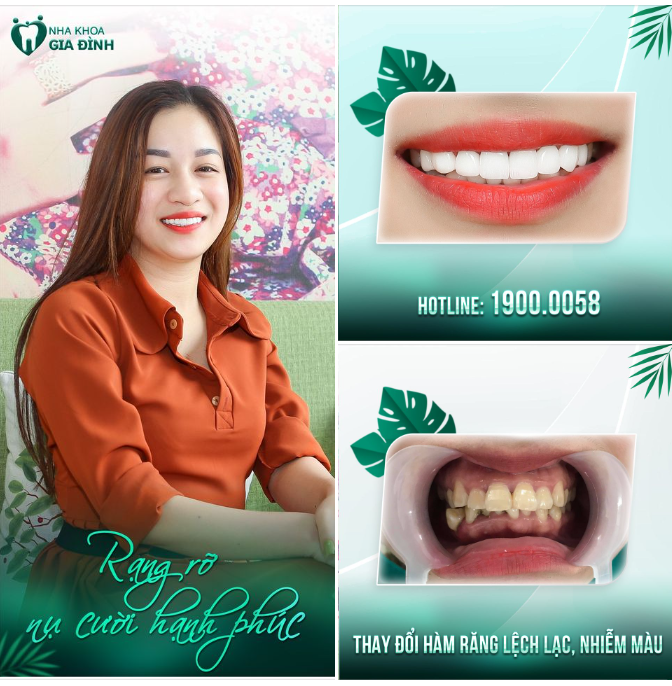 RẠNG NGỜI HẠNH PHÚC NGÀY VỚI NỤ CƯỜI MỚI