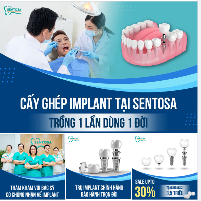 SENTOSA – NHA KHOA HÀNG ĐẦU TRONG LĨNH VỰC CẤY GHÉP IMPLANT