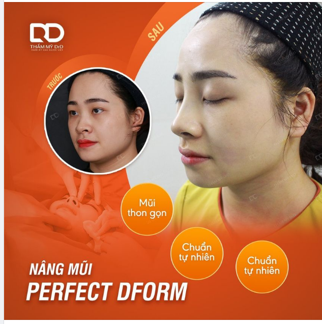 SƯNG NỀ SAU NÂNG MŨI - NGUYÊN NHÂN TỪ ĐÂU