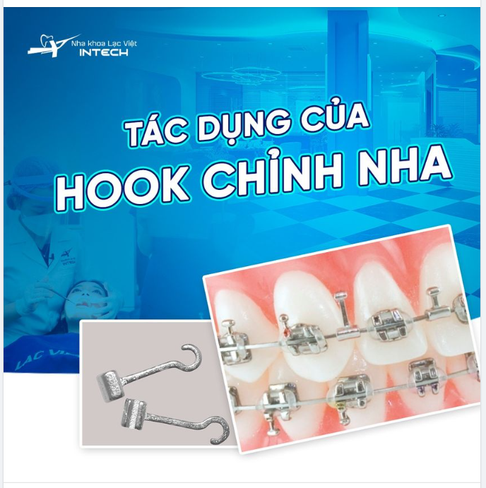 TÁC DỤNG CỦA HOOK CHỈNH NHA