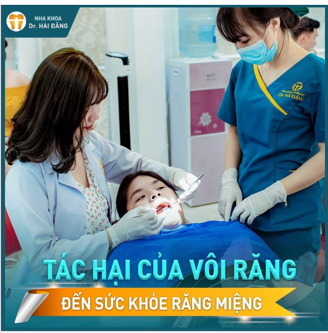 TÁC HẠI CỦA VÔI RĂNG ĐẾN SỨC KHỎE RĂNG MIỆNG