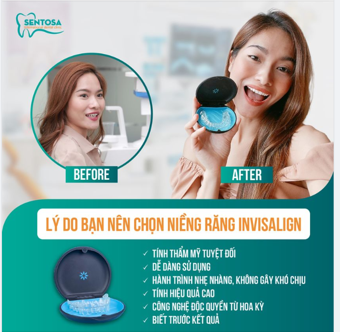 TẠI SAO BẠN NÊN CHỌN NIỀNG RĂNG BẰNG KHAY TRONG SUỐT INVISALIGN